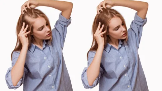 10 Conseils à Suivre Après Une Greffe de Cheveux