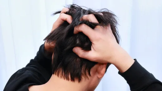 Quelles Sont Les Causes des Démangeaisons Après Une Greffe de Cheveux ?