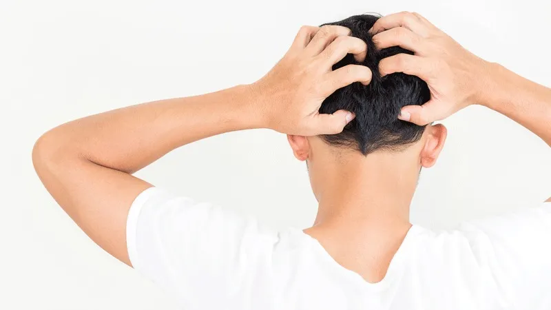 Quelles Sont Les Causes des Démangeaisons Après Une Greffe de Cheveux ?