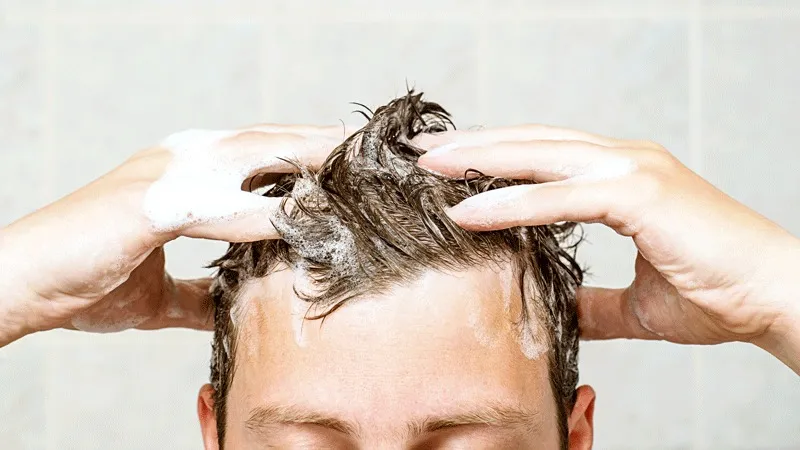 Se Laver Après Une Greffe de Cheveux