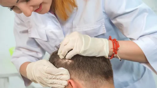 Tourisme de Santé Pour La Greffe de Cheveux en Turquie